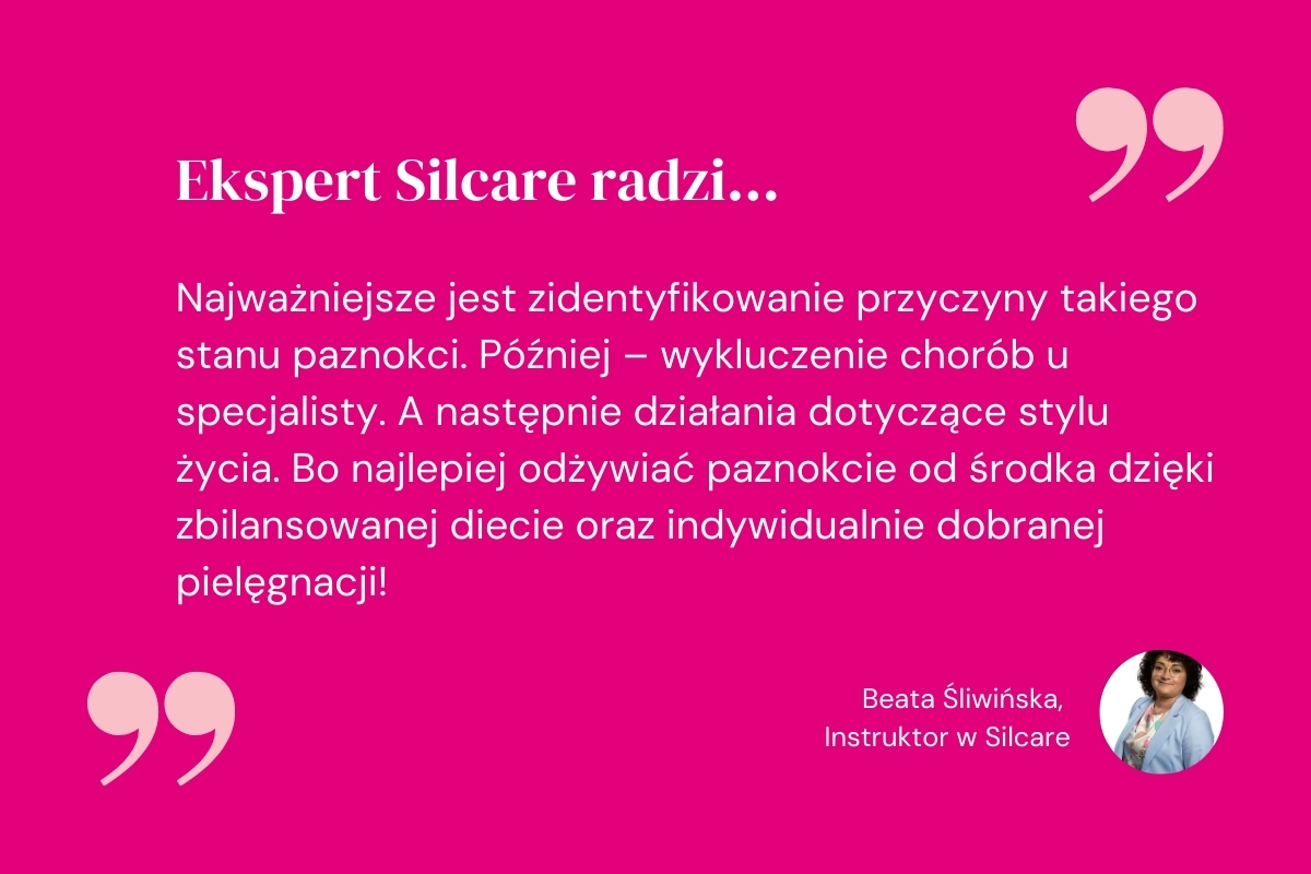 Ekspert radzi