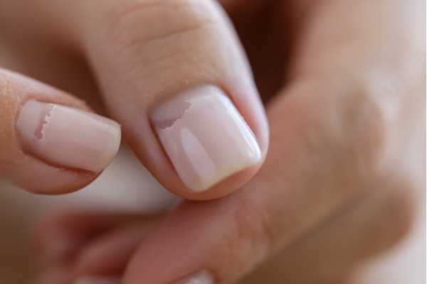 Warum löst sich der UV-Nagellack ab?